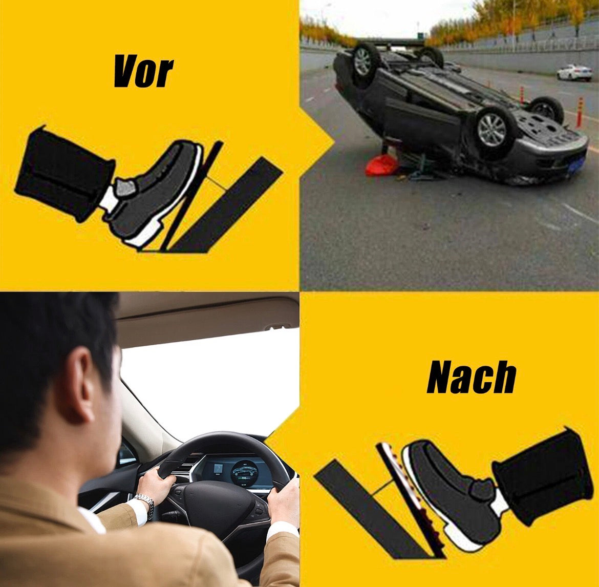 Automatik Sport Pedale Für MercedesBenz W210 W211 W212 W203 W204 W205 W221 W222